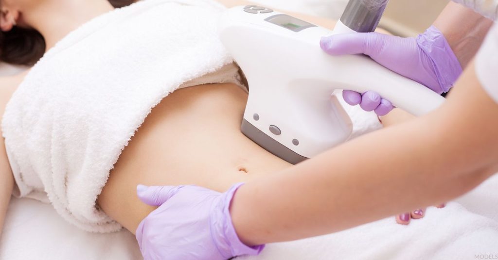 CoolSculpting procedure being performed on a female patient to contour her body. (MODELS)