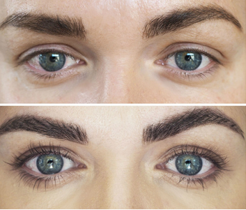 Before and after image showing results from Revitalash