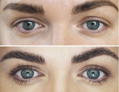 before and after images of eyes showing change from using Revitalash